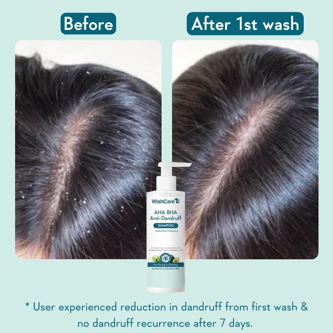 Wishcare AHA BHA Anti Dandruff Shampoo