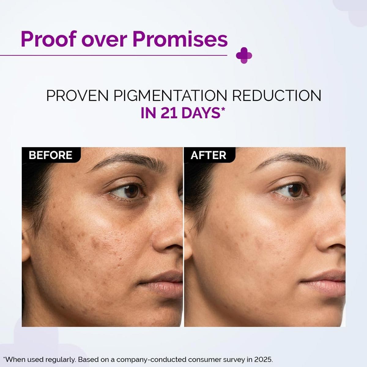 The Derma Co 2% Kojic Acid Serum