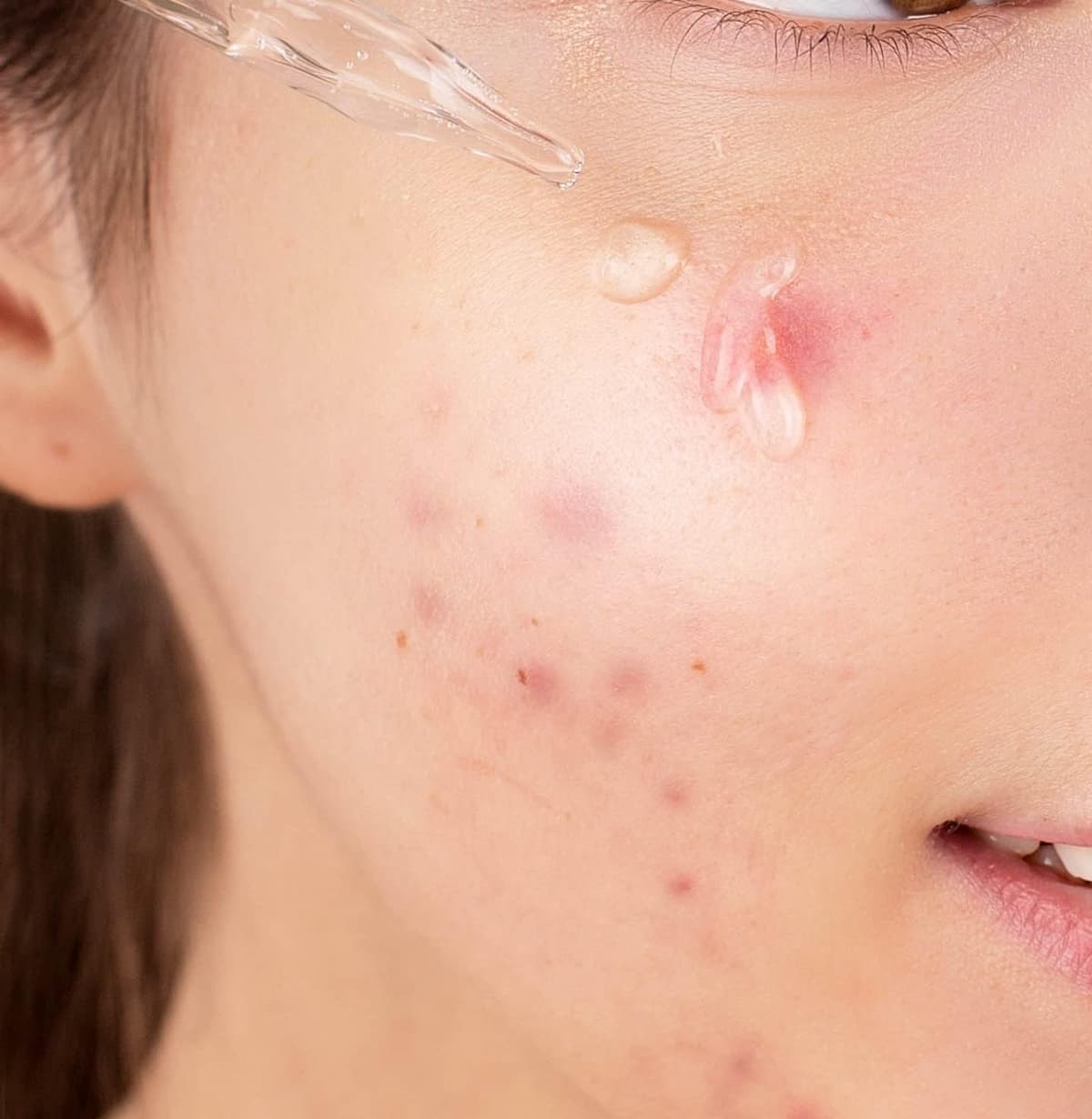 Care Nel Niacinamide Zinc Serum