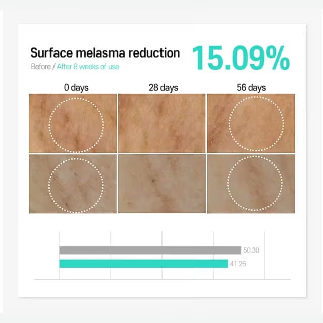 Carenel Anti Melasma Cica Intensive Serum