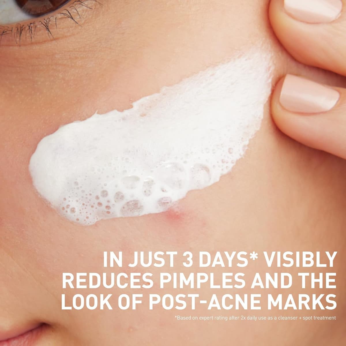 Cera Ve Acne Clay to Foam Cleanser
