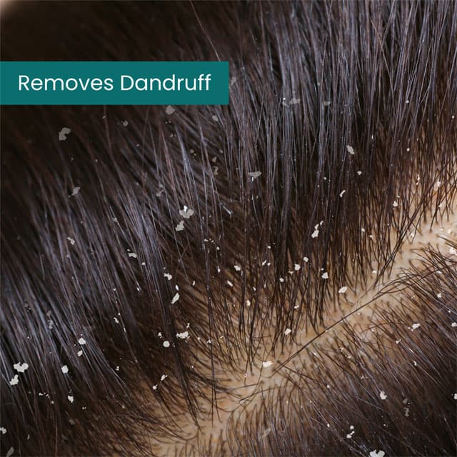 Hair Got Right Scalp Clarifying Anti-Dandruff Shampoo