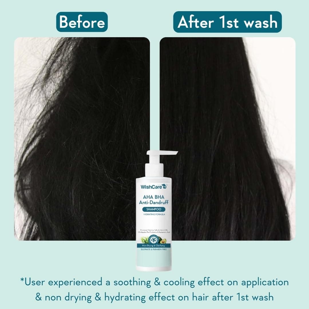 Wishcare AHA BHA Anti Dandruff Shampoo