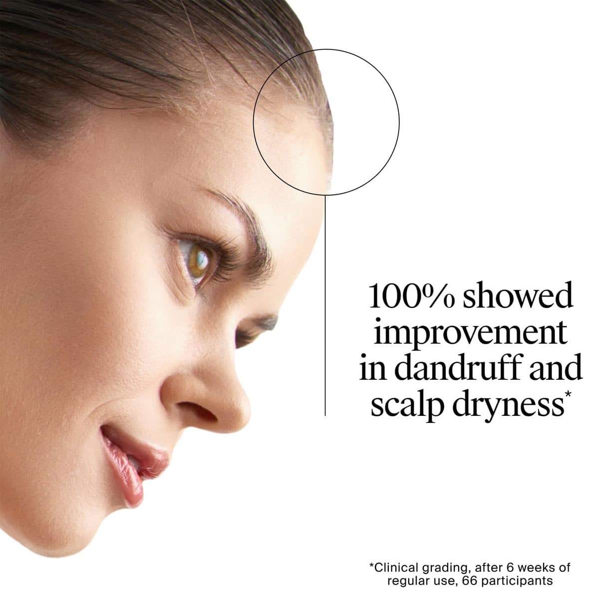 Neutrogena T/Gel Anti-Dandruff Scalp Relief Shampoo