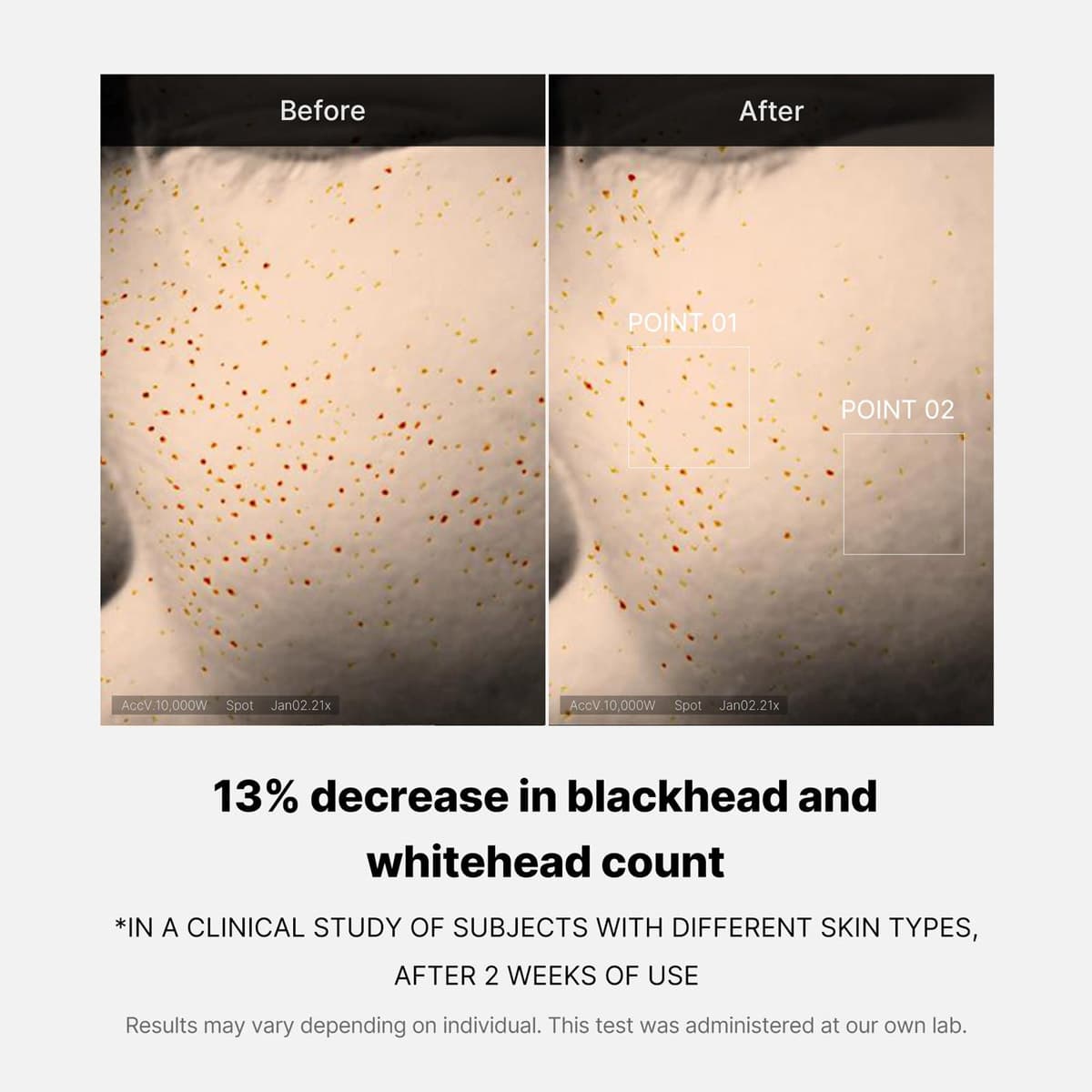 Medicube Zero Pore One Day Serum