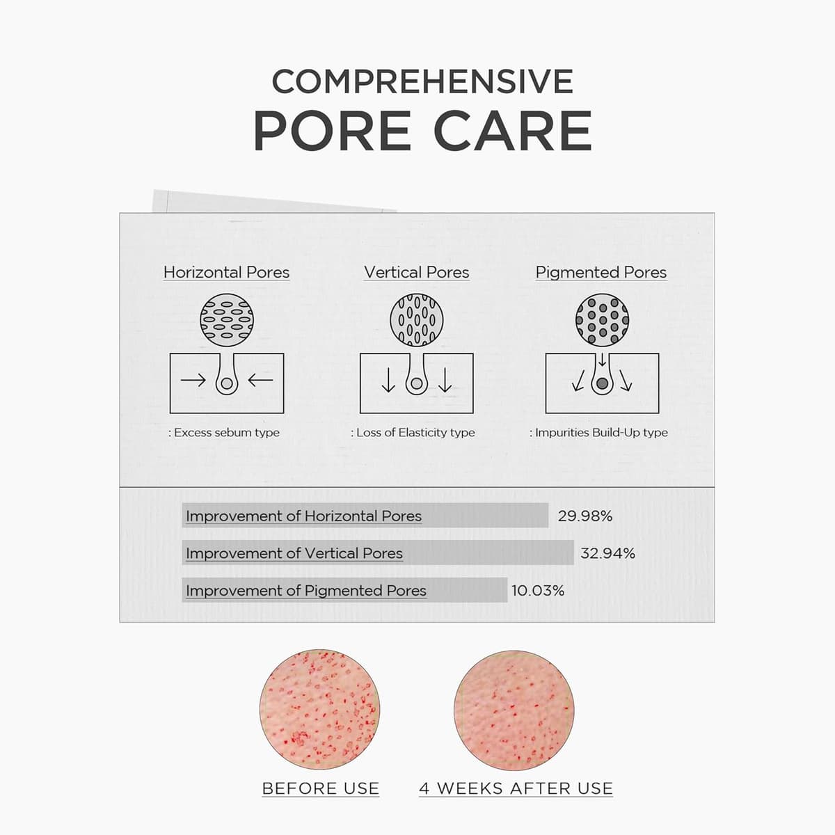 Skin1004 Niacinamide 10 Boosting Shot Ampoule