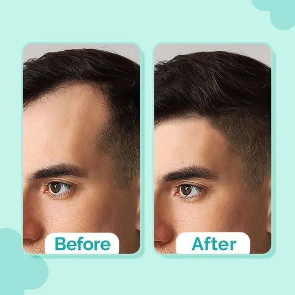 The Derma Co 20% Actives Peptide-Stem Cell Hair Growth Serum