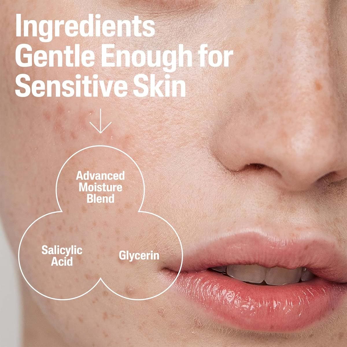 Cetaphil Pore Clearing Acne Cleanser