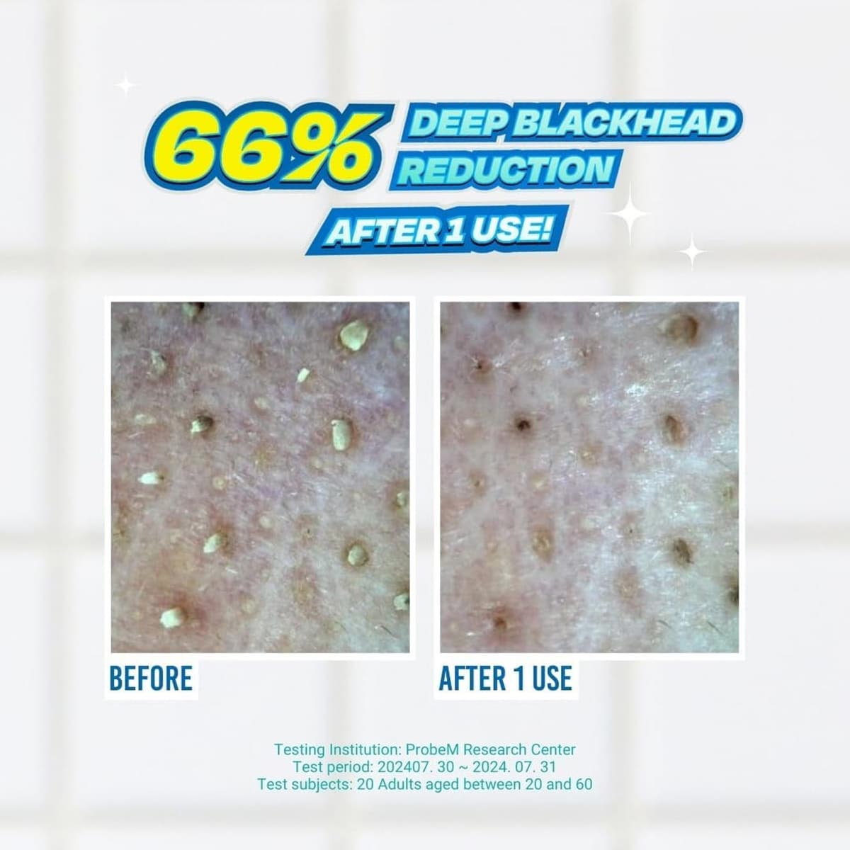 Jumiso Blackhead Melting Softener Special Kit