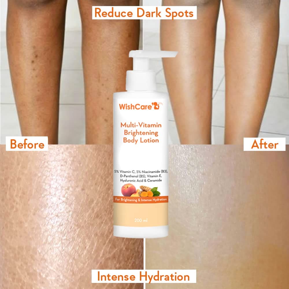 Wishcare Multi Vitamin Brightening Body Lotion