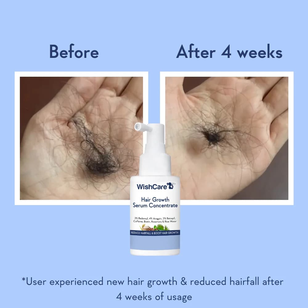 Wishcare Hair Growth Serum Concentrate