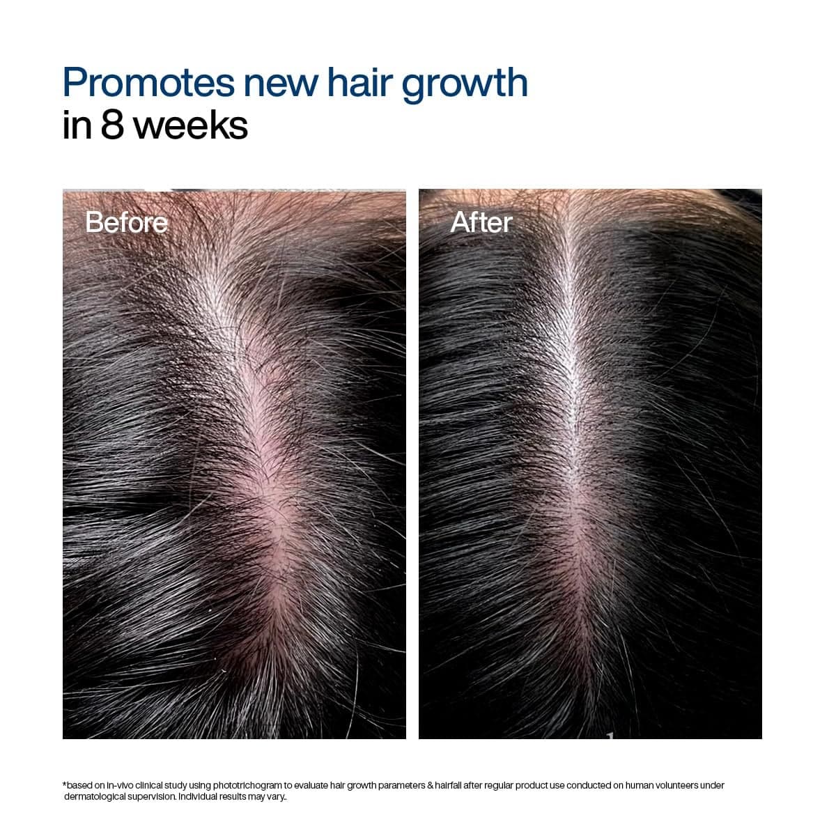 Wishcare Hair Growth Serum Concentrate Roll-on