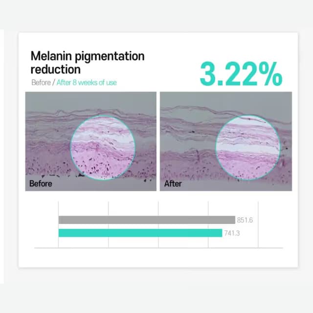 Carenel Anti Melasma Cica Intensive Serum