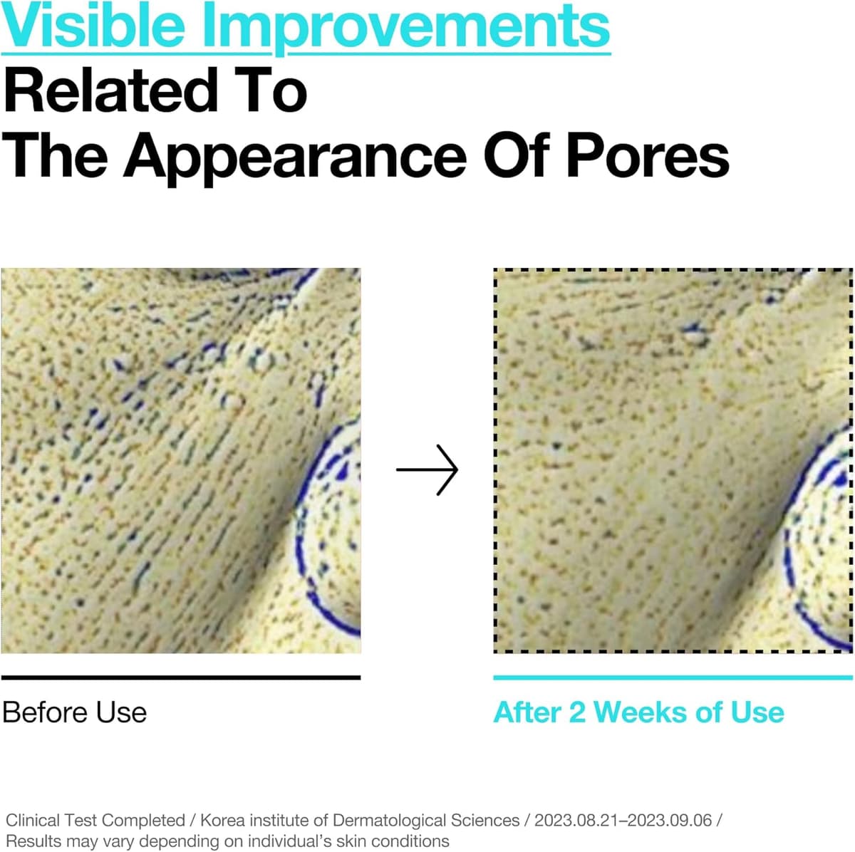 Anua BHA 2 Gentle Exfoliating Toner