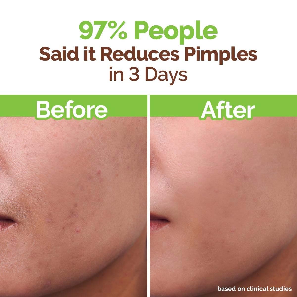 Mamaearth Tea Tree Pimple Control Face Wash For Oily & Acne Prone Skin