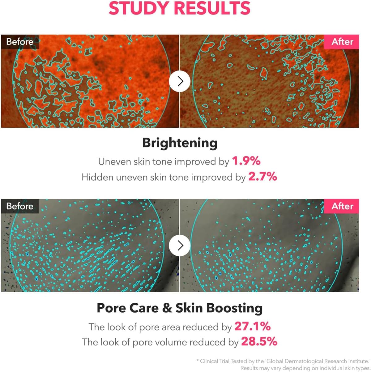 APRILSKIN TXA Niacinamide Toning Shot 99 Serum
