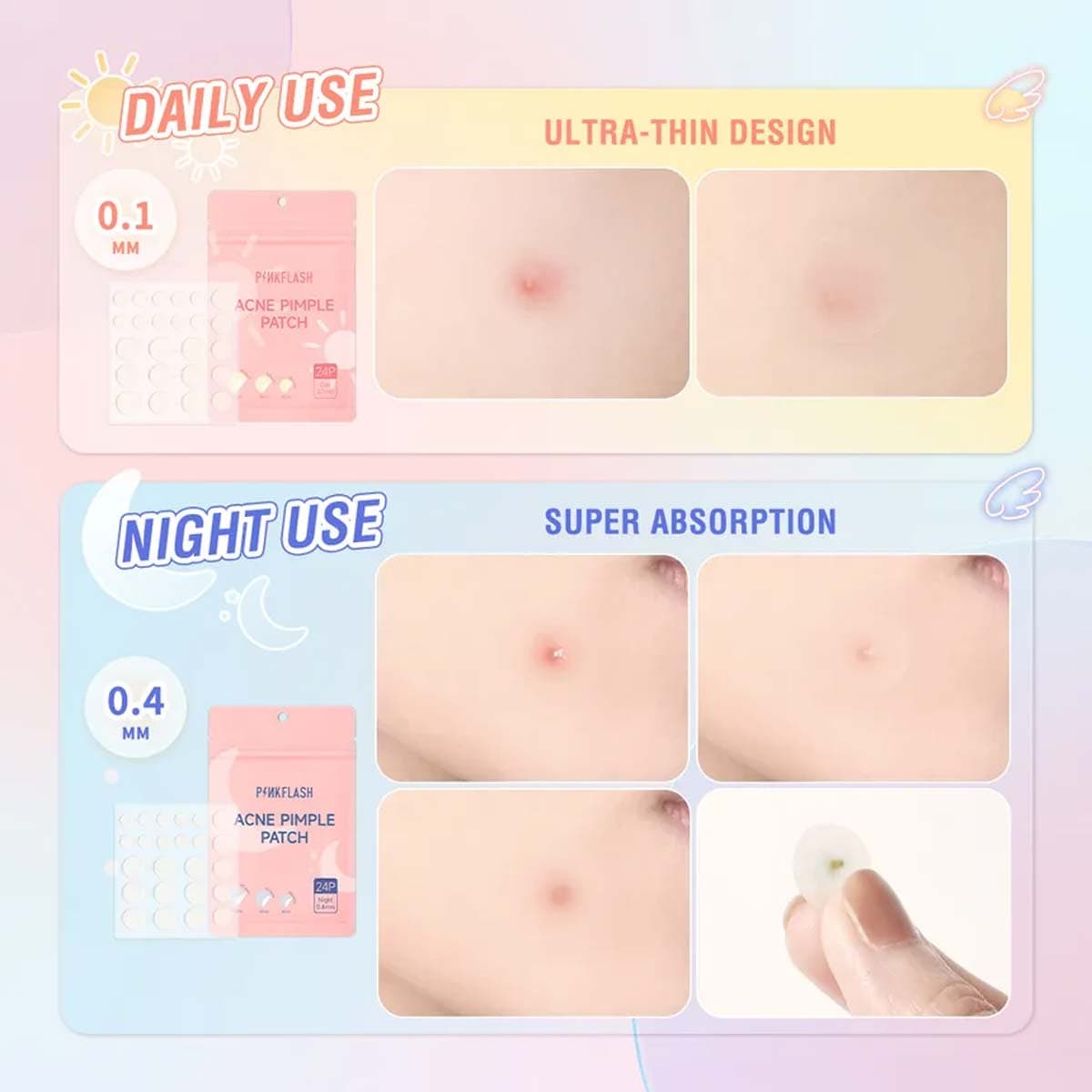 PF-SC58-01 Pink Flash Acne Pimple Day Patch