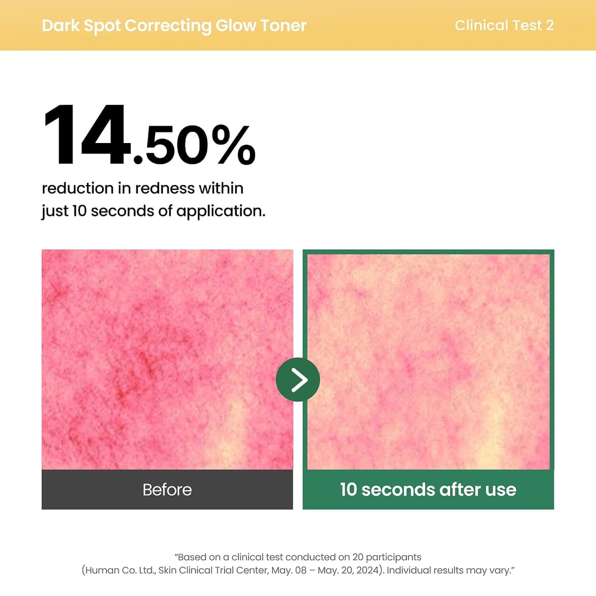 Axis-Y Dark Spot Correcting Glow Toner