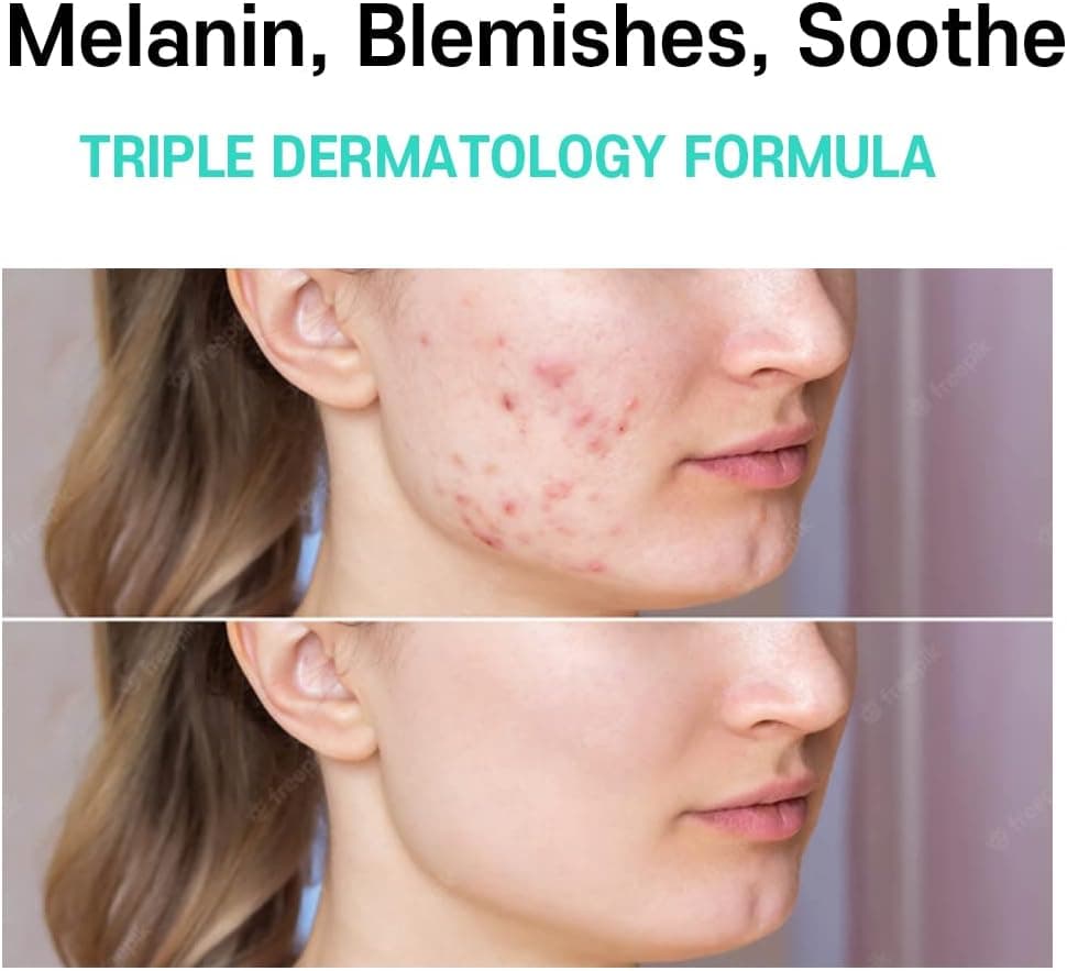 Care Nel Anti-Melasma Cica Cream