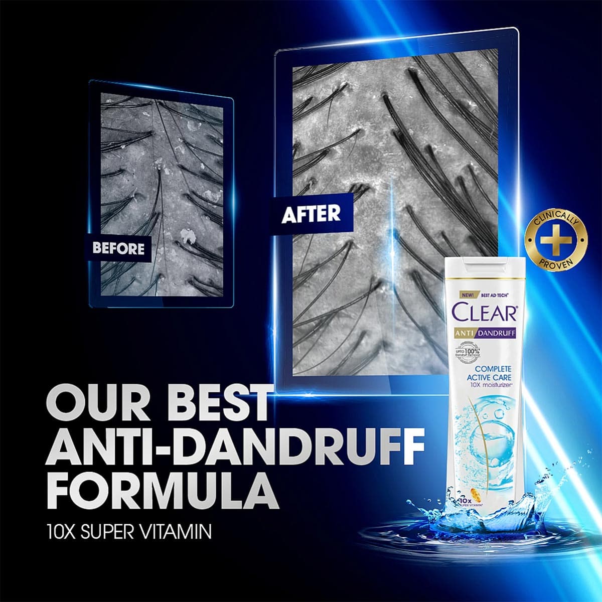 Clear Shampoo Complete Active Care Anti Dandruff