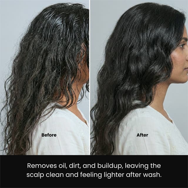 Hair Got Right Scalp Clarifying Anti-Dandruff Shampoo