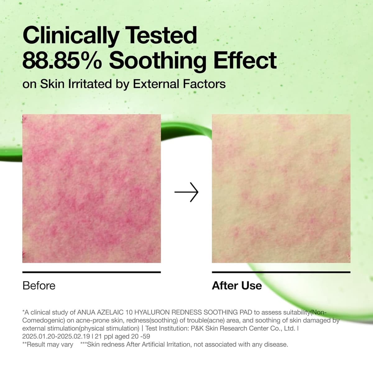 Anua Azelaic 10 Hyaluron Redness Soothing Pad