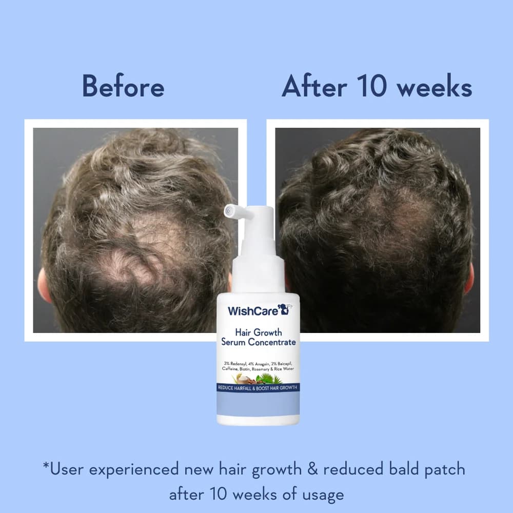 Wishcare Hair Growth Serum Concentrate