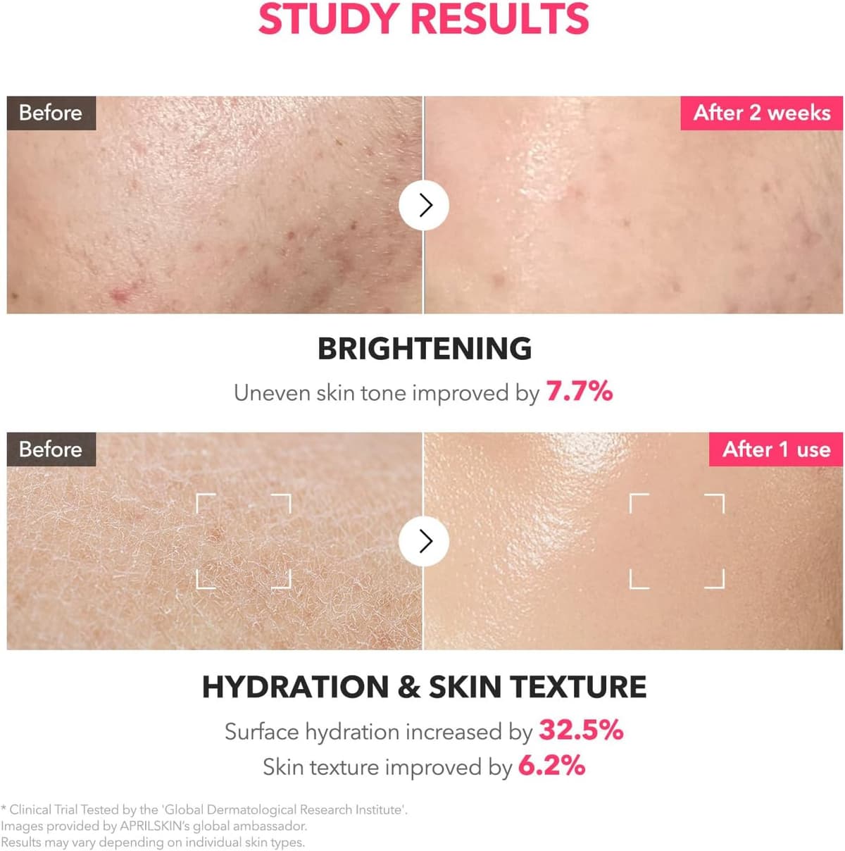 APRILSKIN TXA Niacinamide 99 Milky Toner