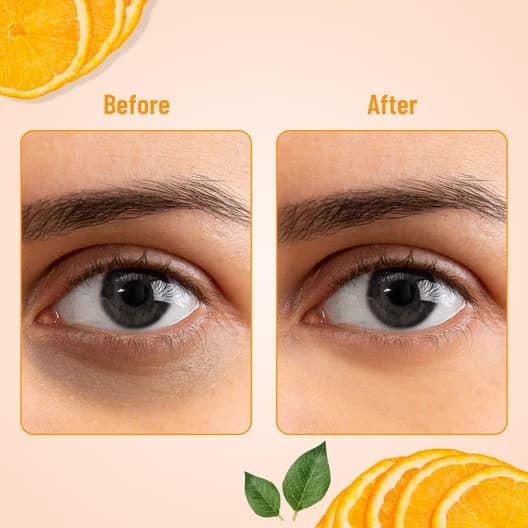 Swiss Beauty Hydra Eye Serum Patch with Vitamin C - 60pcs