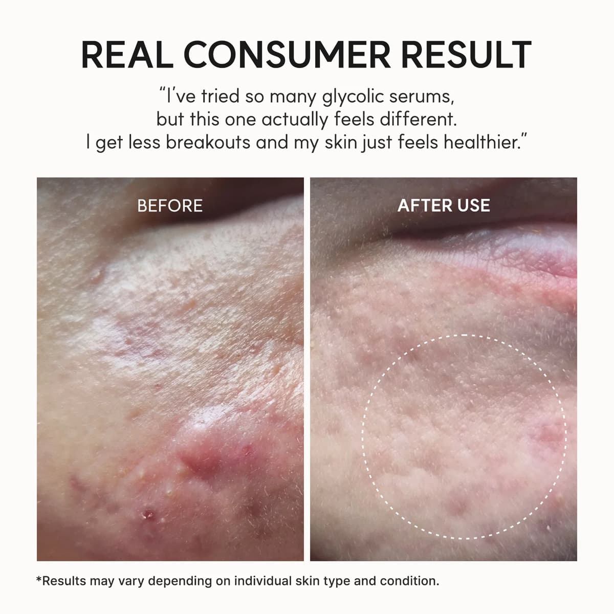Arencia Eraser Shot Glycolic Acid Booster