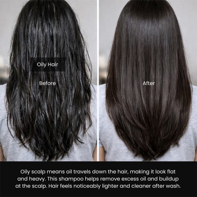 Hair Got Right Scalp Clarifying Anti-Dandruff Shampoo